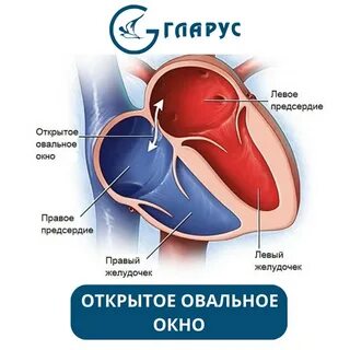 Мембрана овального окна