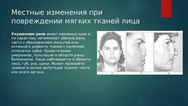 Вид повреждения лица. Вид повреждения лица. Классификация травматических поражений чло. Повреждения мягких тканей чло. Вид повреждения лица.