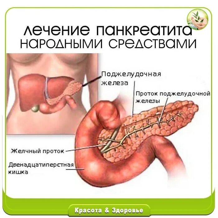 Можно ли вылечить панкреатит. Как лечить панкреатит. панкреатит народные методы. панкреатит лечится.