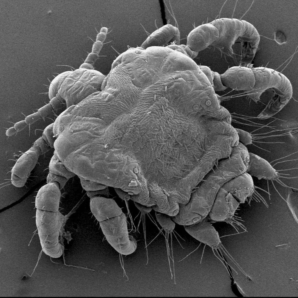 Lice and nits: where they come from, what they look like. Head lice, pubic lice,