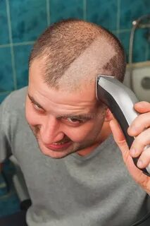 Бреюсь налысо