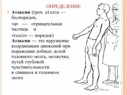 Абазия это