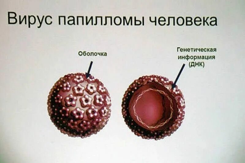 Что вызывает впч