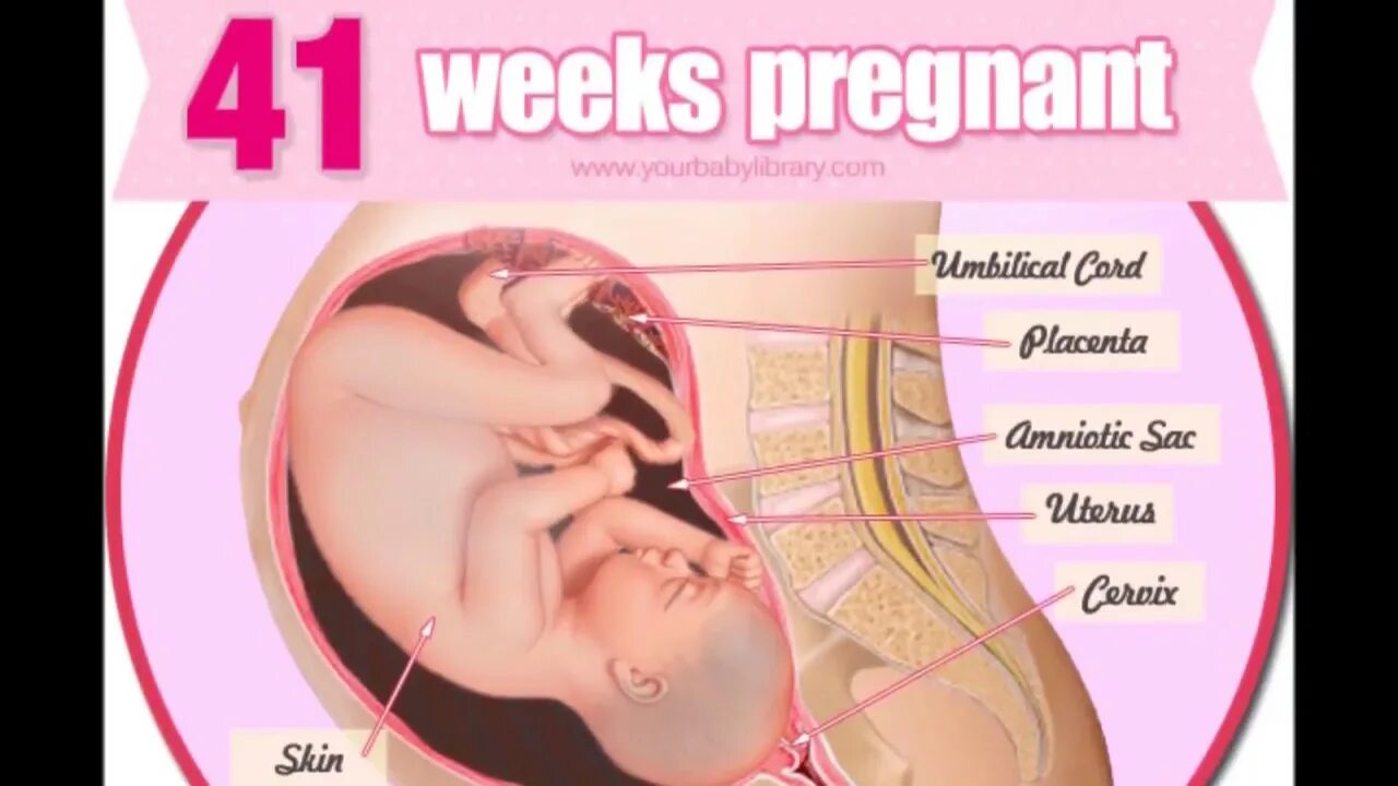 41 неделя отошла. Ребенок на 41 неделе беременности. Роды на 41 неделе беременности. Беременность 40-41 неделя.
