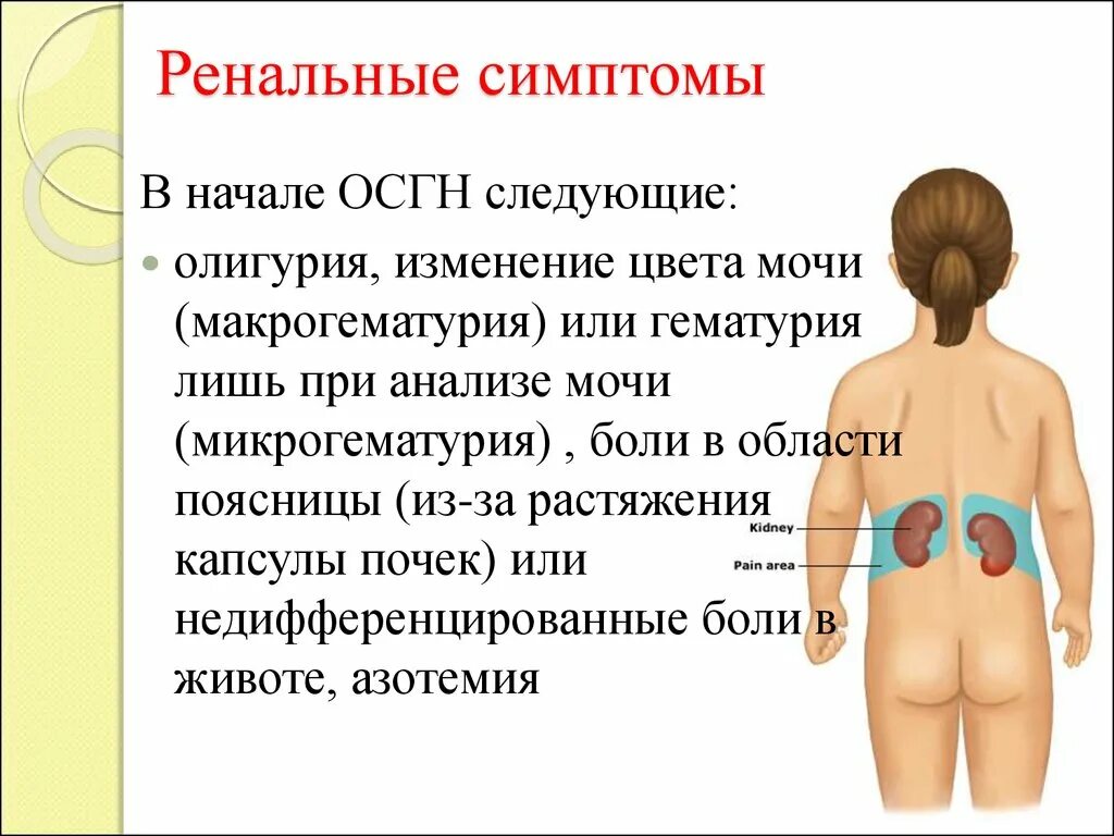 Болят почки признаки и симптомы. Болят почки симптомы. Ренальные симптомы. Как поня ь что болят почки. Как понять что колят почки.