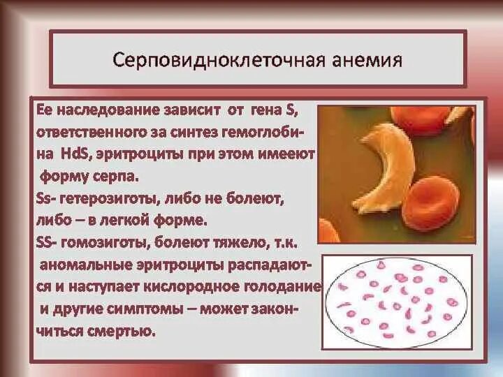 Серповидноклеточная анемия эритроциты форма. Серповидная клеточная анемия симптомы. Серповидно-клеточная анемия проявление болезни. Тип наследования серповидно-клеточной анемии. Серповидно клеточная анемия признаки