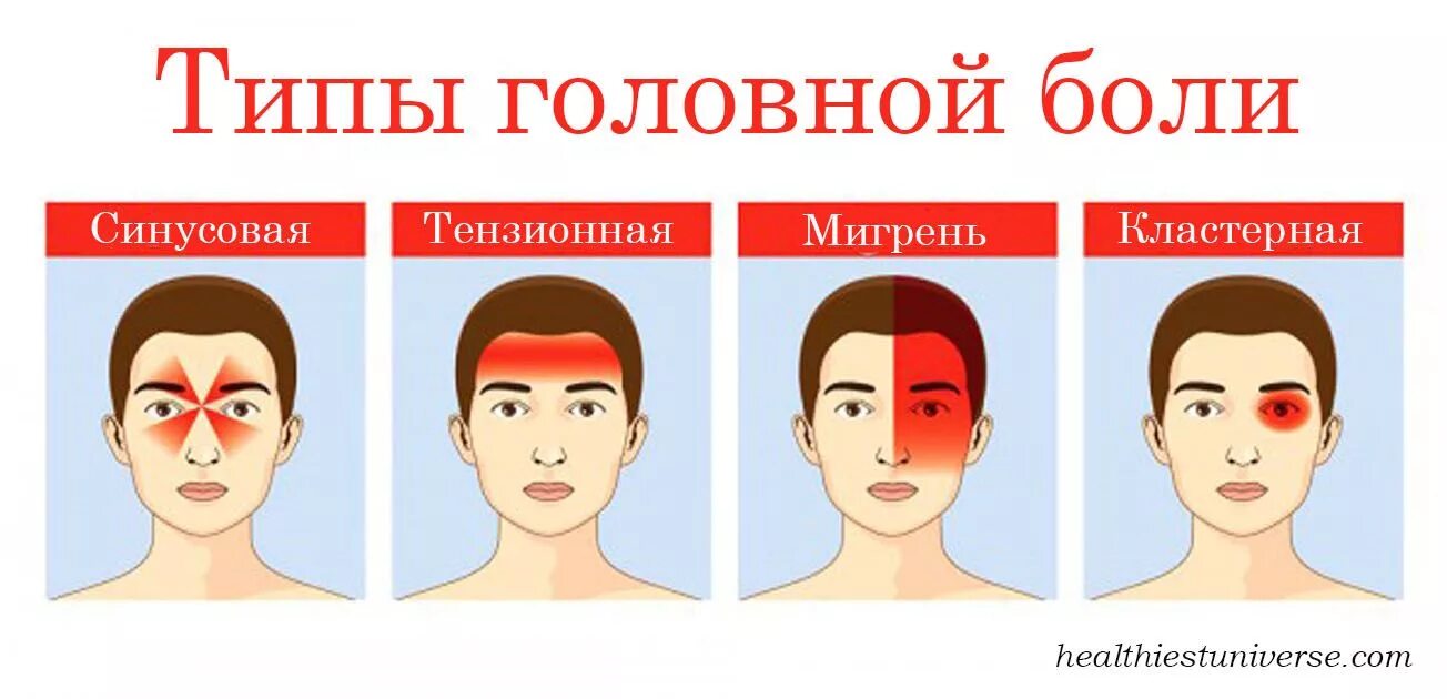 Типы боли. Типы головной боли. виды боли в голове. боль в голове разные зоны. синусовая головная боль.