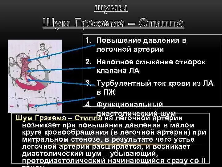 Расчетное давление в легочной артерии. Оценка давления в легочной артерии. Давление заклинивания легочной артерии. Повышение давления в легочной артерии.