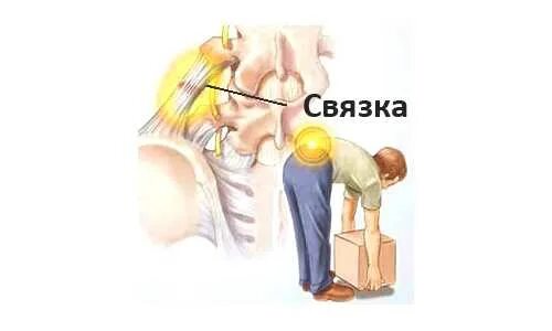 Сорвал спину