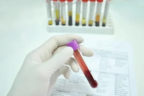 Клинические лабораторные тесты