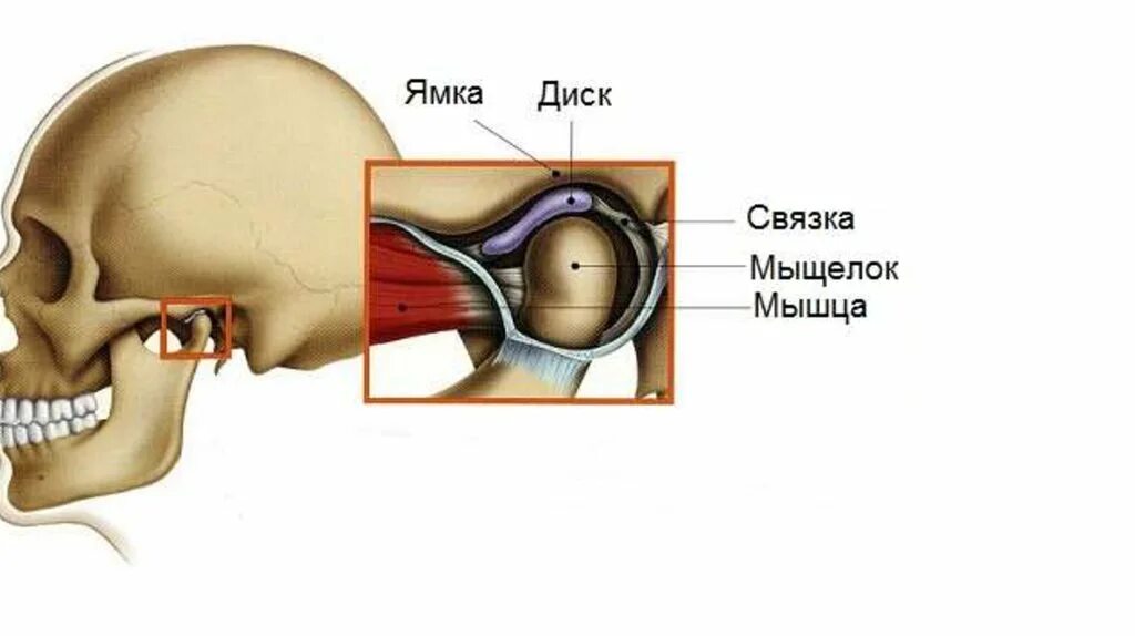 Дисфункция височно-нижнечелюстного сустава. Артроз ВНЧС асимметрия. Мыщелок челюсти