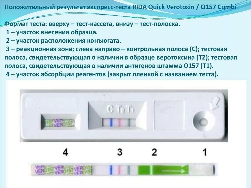 Ковид положительный что делать 2024. Экспресс тест на ковид т1 т2. Тест кассета теста на ковид. Положительный результат экспресс теста на коронавирус. Экспресс тест экспресс тест экспресс тест.