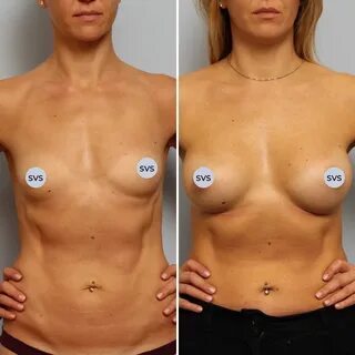 Главное, чтобы грудь была красивой и естественной! 