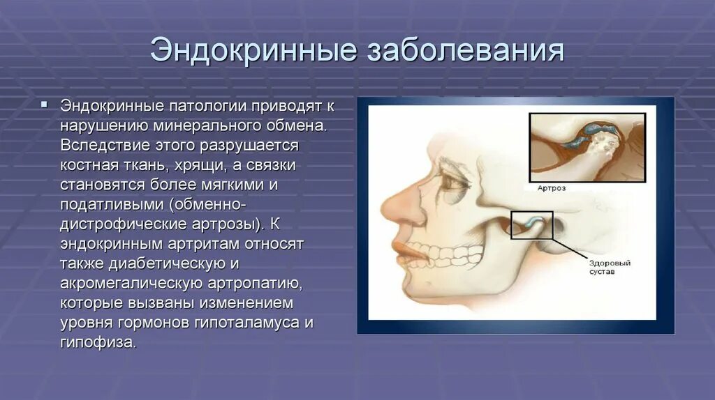 Эндокринология заболевания. Патологии эндокринной системы. Заболевание эндокринные заболевания. Заболевания с нарушением эндокринной системы.