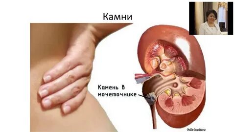 Правосторонняя почечная