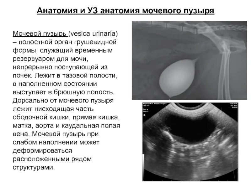 Как быстро наполнить мочевой пузырь. Пристеночные образования в мочевом пузыре на УЗИ. УЗИ мочевого пузыря поперечный срез. Стенки мочевого пузыря анатомия по УЗИ. УЗИ мочевого пузыря нормальные показатели.