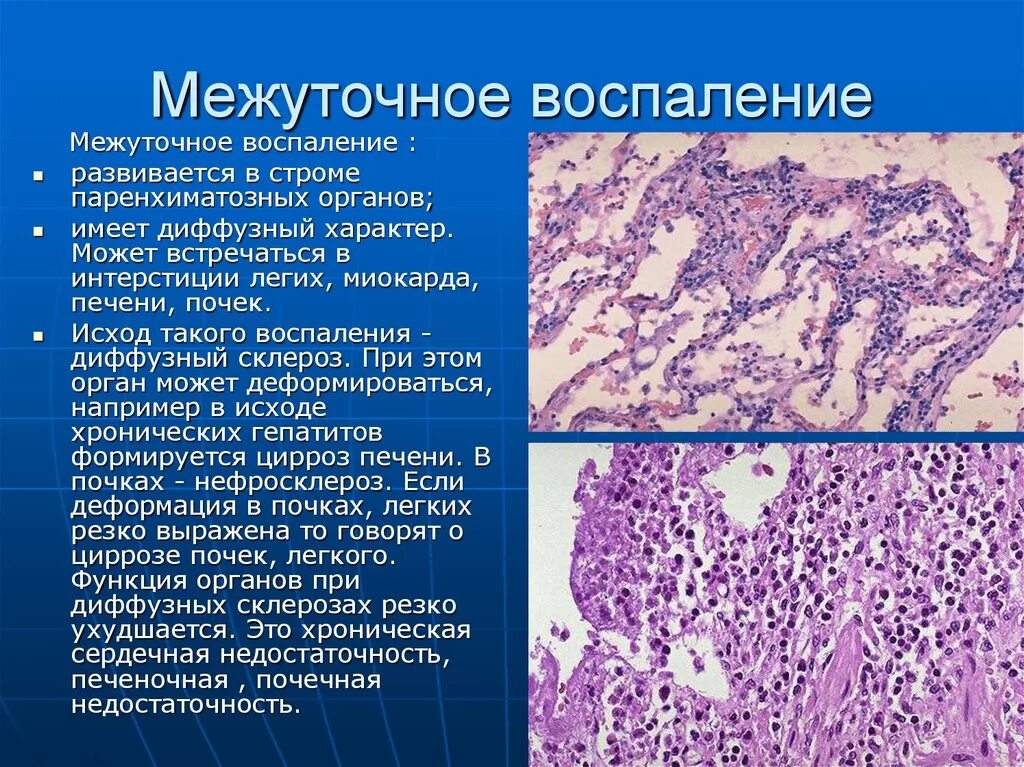 Умеренные неспецифические изменения