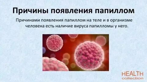 Вирус папилломы 4