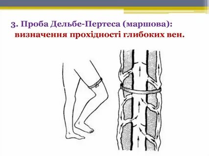 Пробы вен