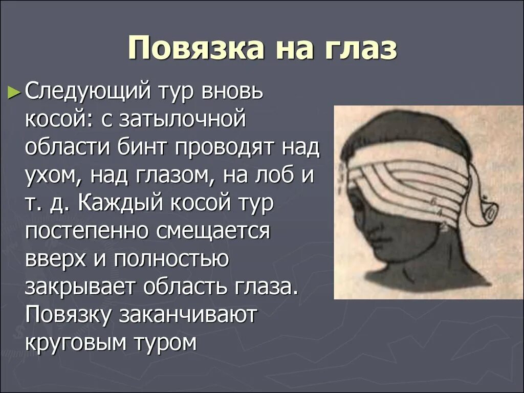 Какой полководец носил повязку на глазу. Бинокулярная повязка на оба глаза. Бинокулярная повязка на глаз алгоритм. Алгоритм наложения монокулярной повязки на глаз. Повязка на оба глаза бинокулярная алгоритм.