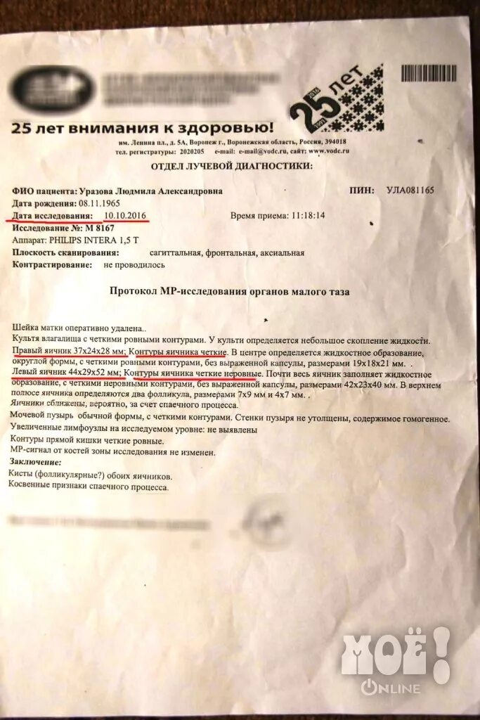 Отзывы пациентов после удаления яичников. Отзывы пациентов после удаления яичников