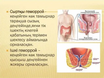 Порно күйеуін жалауға мәжбүр етті