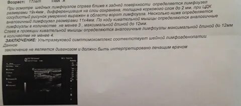 Увеличены лимфоузлы анализы