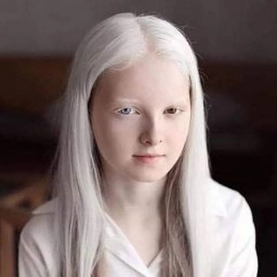 Катерина Тимошенко альбинос. Саша Смирнов альбинос.