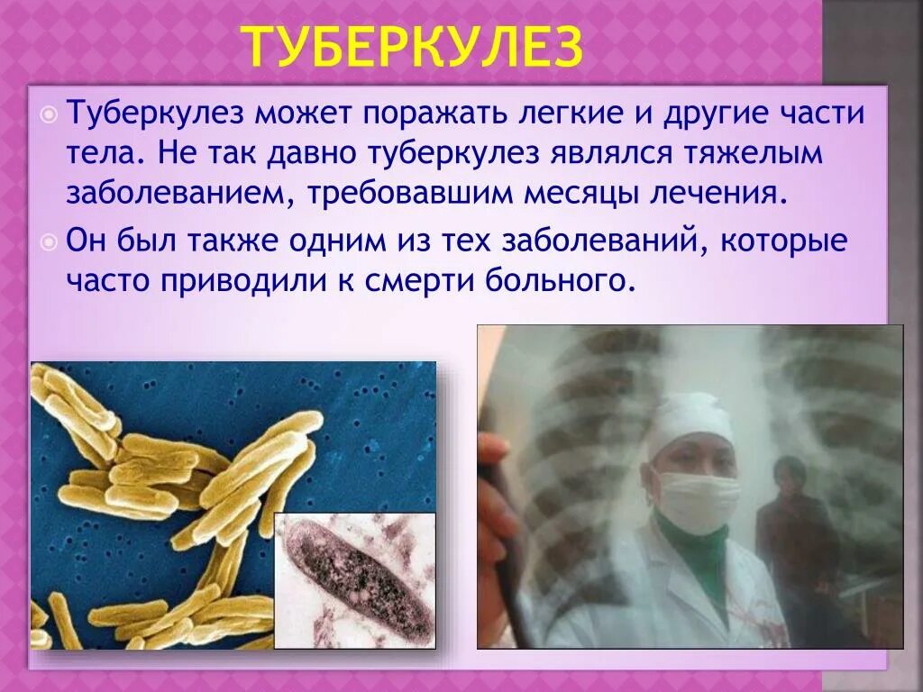 Tuberkulyoza. Туберкулез латынь