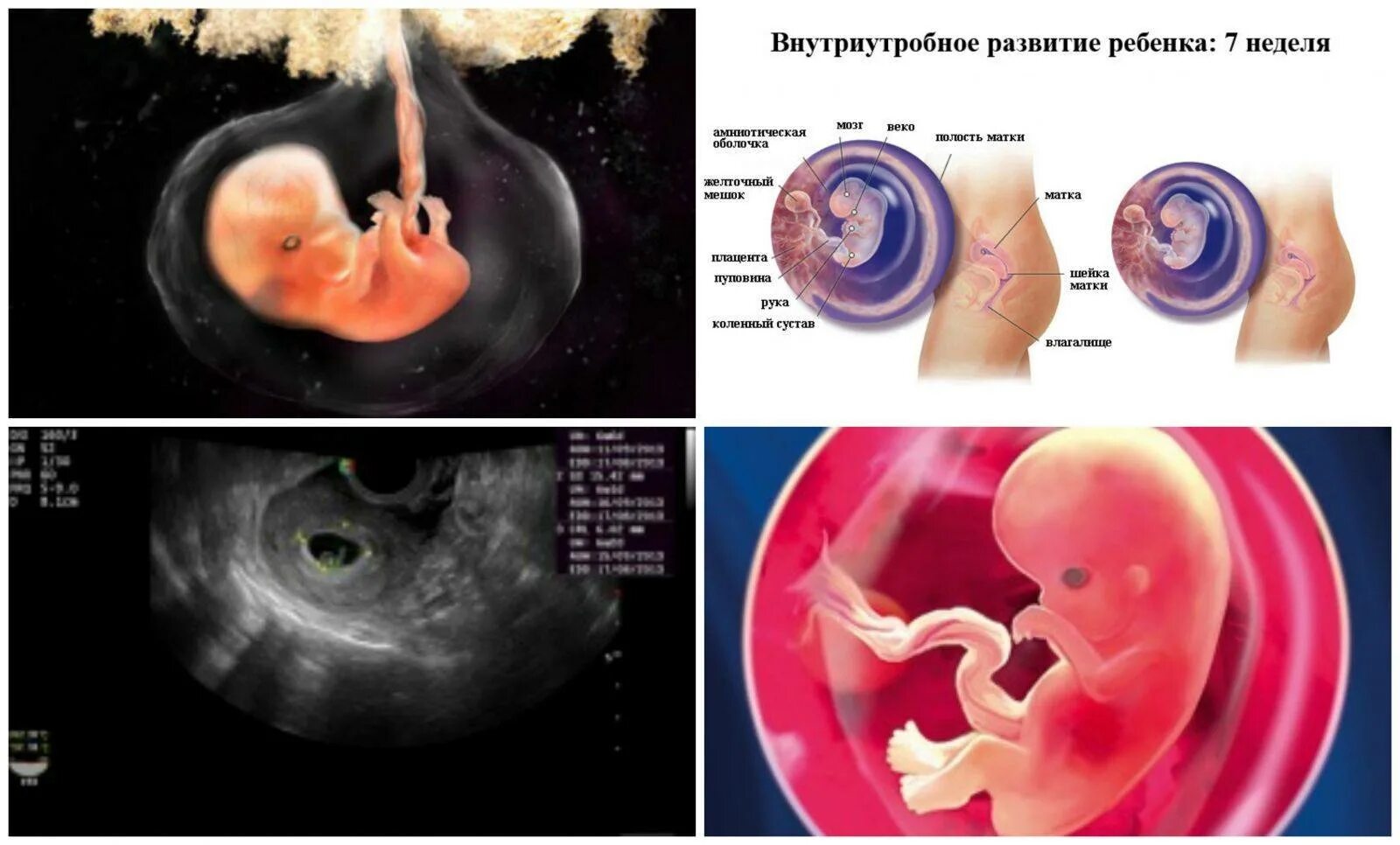 Матка 6 7 недель. Эмбрион по неделям беременности 6-7 недель. Плод эмбриона на 7 неделе беременности. Эмбрион по неделям беременности 7 недель беременности. Фото эмбриона по неделям беременности 7 недель.
