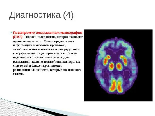 Позитронно-эмиссионная томография. Позитронно-эмиссионная томография мозга. Позитрон-эмиссионная  томография: ПЭТ. Позитронно эмиссионная томография болезнь Альцгеймера.