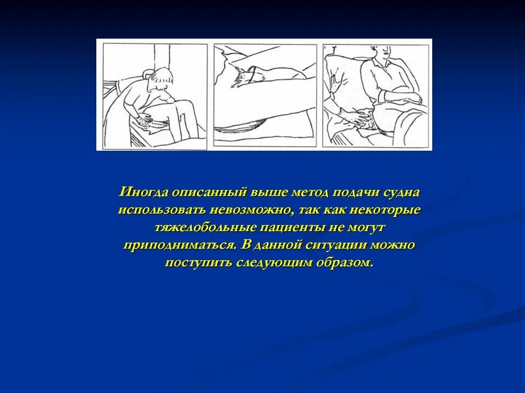 Подача судна алгоритм. Подача мочеприемника тяжелобольному пациенту алгоритм. Подача судна тяжелобольному пациенту алгоритм. Подача судна и мочеприемника. Подача судна.