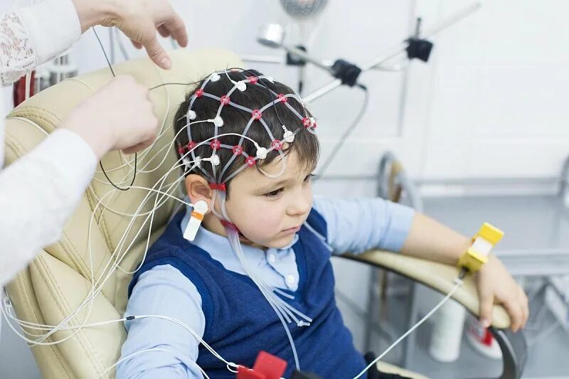 Ээг невролог. Электроэнцефалография (ЭЭГ). Электроэнцефалография головного мозга (ЭЭГ). РЭГ И ЭЭГ. ЭЭГ детям.
