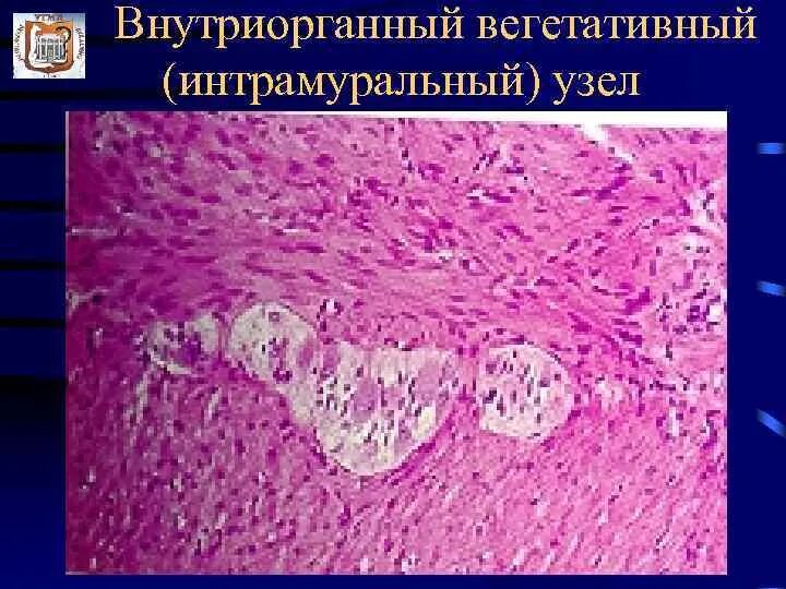 Интрамуральный узел тип 4. Интрамуральный ганглий мочевого пузыря гистология. интрамуральный узел гистология. интрамуральные ганглии препарат. интрамуральный нервный узел.