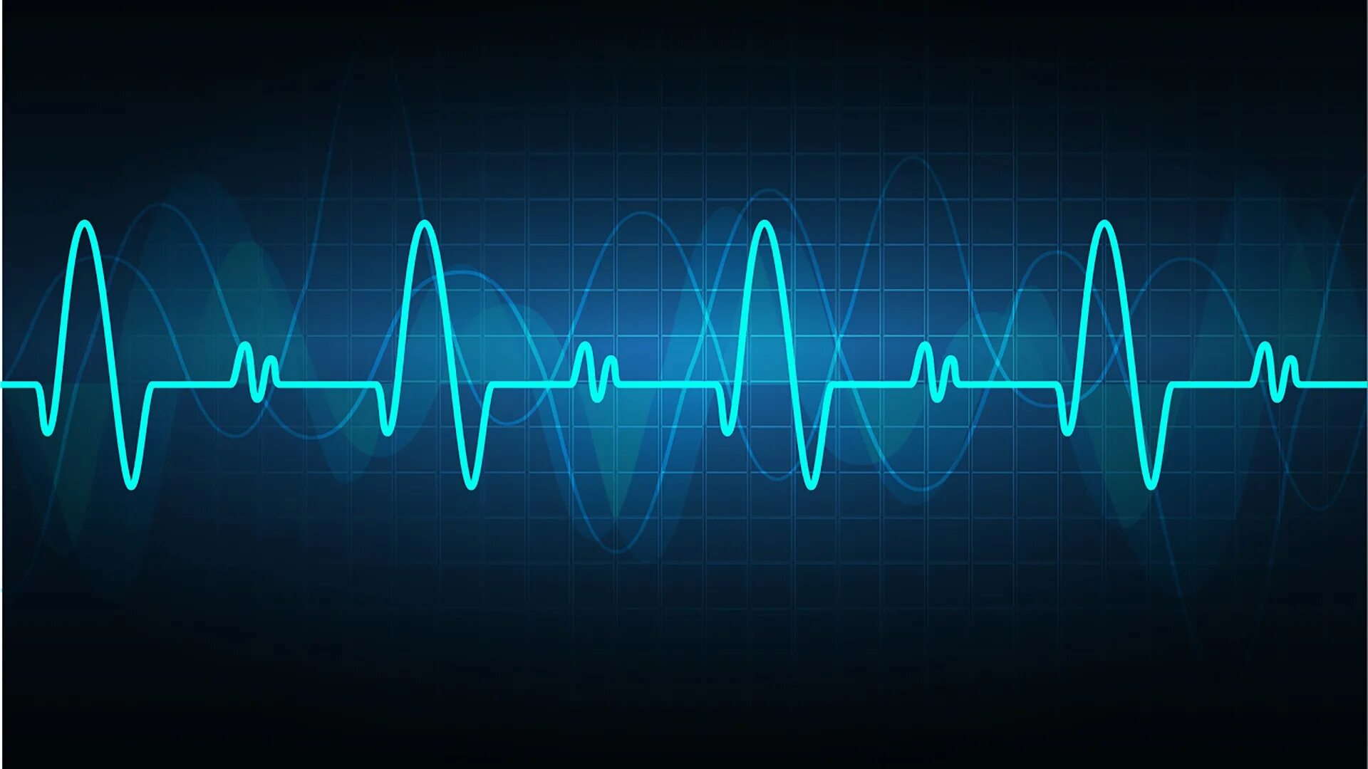 Пульс. Кардиограмма сердца. Такт пульса. Доли такта в музыке. Пульс сердца.