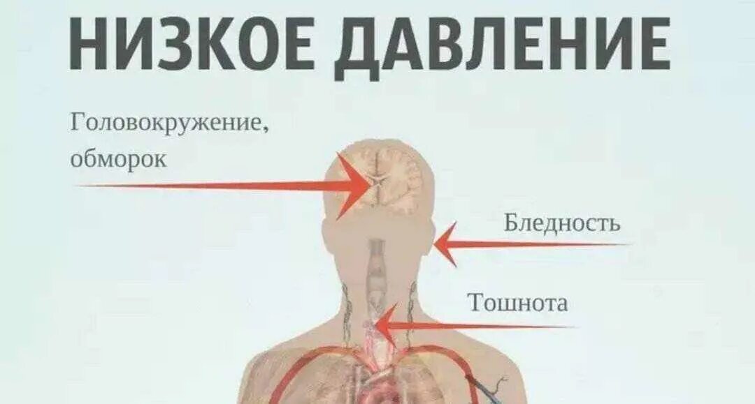 Почему после давления болит голова. Что поднимает давление. Что повышает давление. Что повышает давление в домашних. Чем повысить давление.