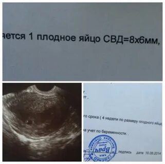 Свд 6 недель