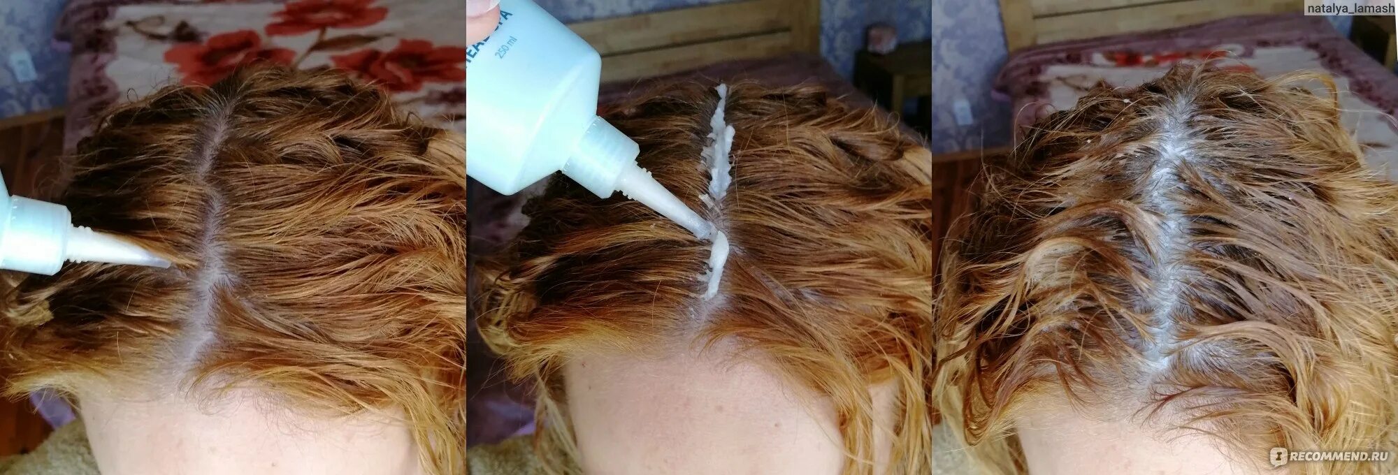 Глубокая очистка головы. Пилинг Happy hair Scalp peeling. Пилинг кожи головы до и после. Глубокая очистка кожи головы.