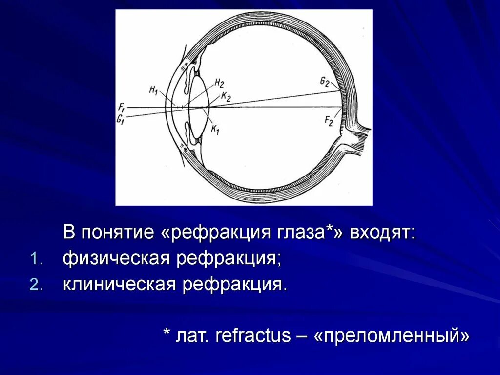 Аберрация в офтальмологии. Метропичнскпя рефракция. Аномалии рефракции глаза (близорукость, дальнозоркость, астигматизм). Сферическая рефракция. Сферическая рефракция.