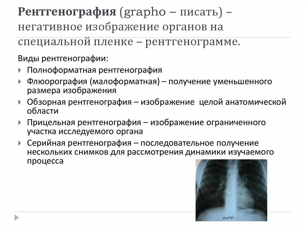 Рентген определение