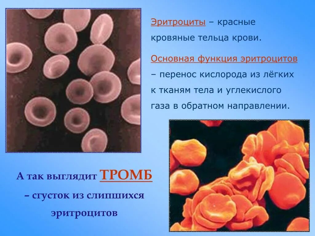 Синдром тельца. Тромб - сгусток эритроцитов. Функции эритроцитов в крови. Красные кровяные тельца эритроциты. Эритроциты склеиваются.