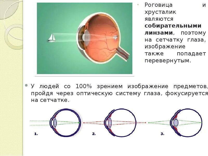 Какое изображение появляется на сетчатке глаза. Оптическая схема глаза человека. Фокусировка изображения на сетчатке. Фокусировка зрения на сетчатке. Изображение фокусируется на сетчатке.