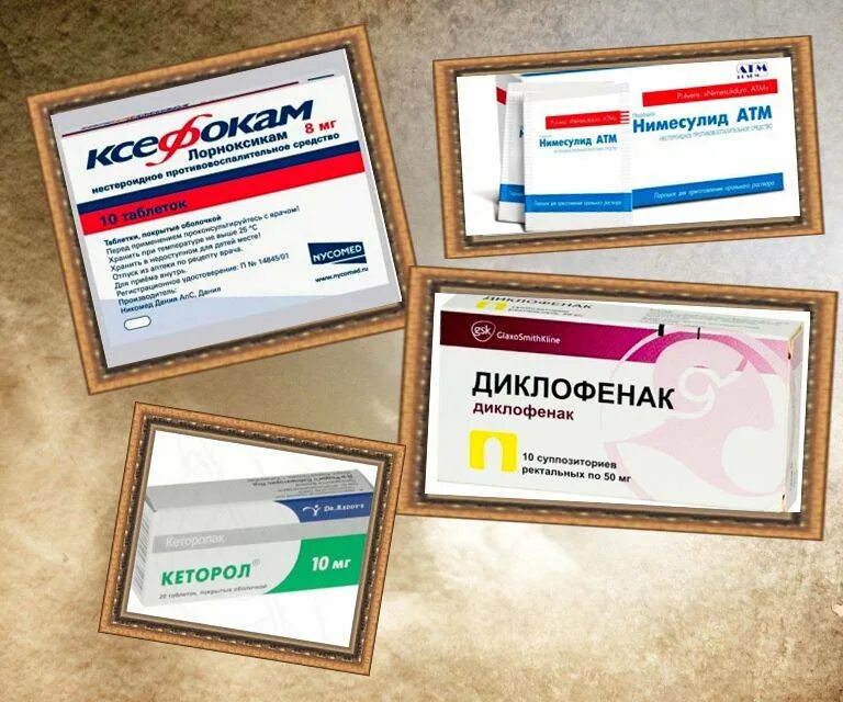 Препараты от невралгии грудного отдела и межреберной невралгии. Препараты от остеохондроза грудного отдела таблетки. Лекарства при остеохондрозе. Лекарства при остеохондрозе поясничного отдела таблетки. Остеохондроз поясничного отдела таблетки обезболивающие.