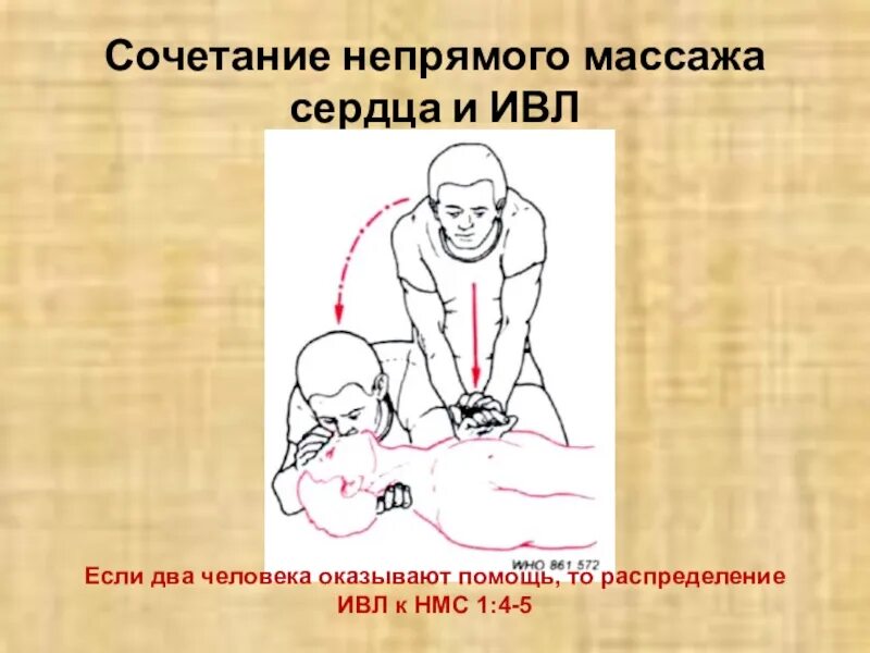 Искусственная вентиляция и непрямой массаж сердца. Сочетание непрямого массажа сердца и ивл. соотношение ивл и непрямого массажа сердца.