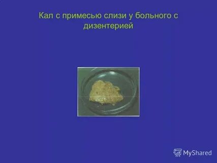 Какой стул при поносе