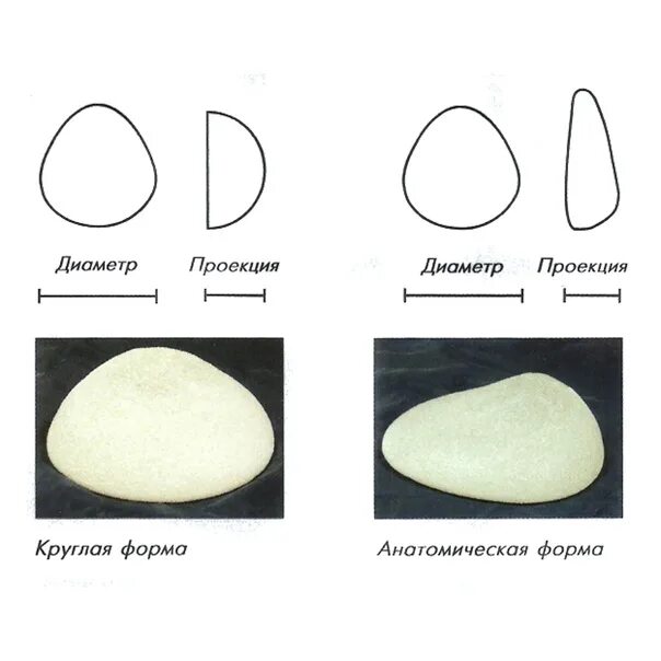 В отличии от круглых. Импланты круглые и анатомической формы. Анатомическая форма грудных имплантов и круглых. Каплевидные импланты и круглые. Внатомияечкая форма инмплатнов и крцгла.