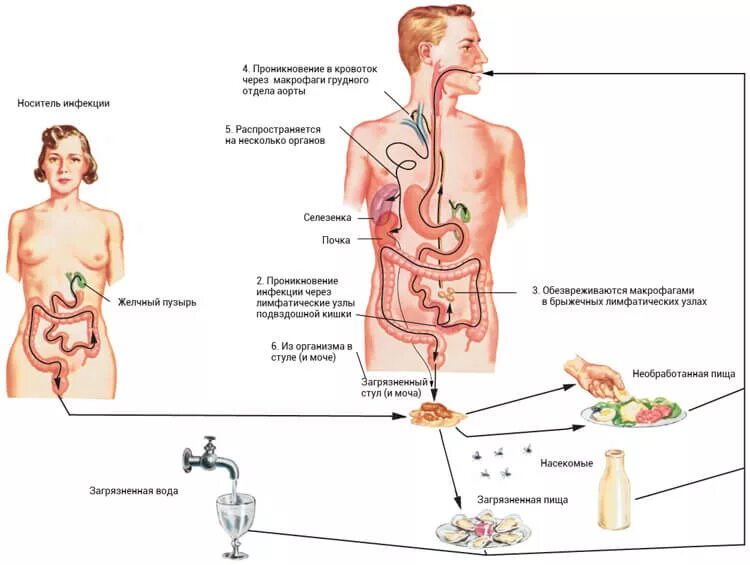 Механизм передачи при брюшном тифе. Патогенез симптомов брюшного тифа. Брюшной тиф пути передачи. Брюшной тиф пути передачи инфекции. Вода проникающие в организм