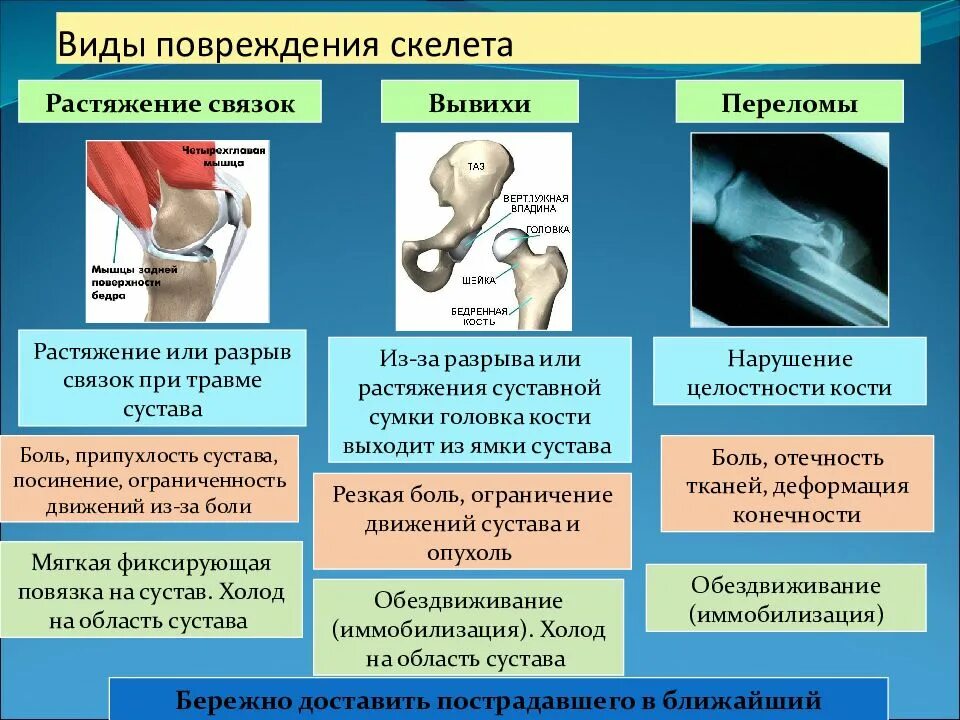 Растяжение виды. Повреждения скелета признаки и первая помощь. виды повреждений скелета признаки первая помощь. таблица травматические повреждения вывихи растяжения. первая помощь при ушибах переломах костей и вывихах суставов таблица.