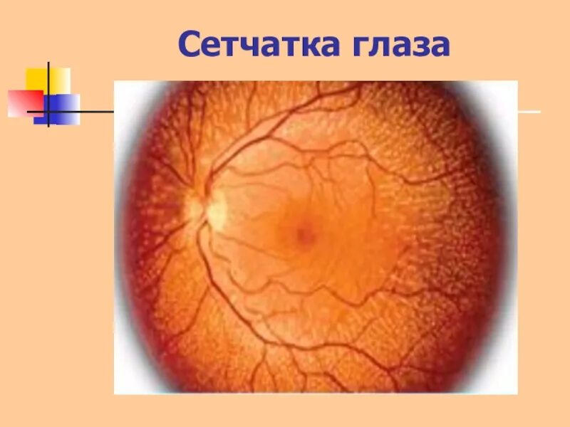 Пигментный ретинит сетчатки. Сетчатка глаза. Сетчатка оболочка глаза. Сетчатая оболочка глаза.