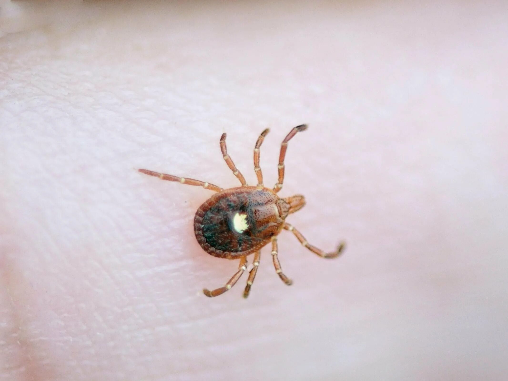 Tick bite make you allergic to
